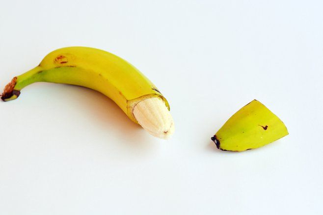 Sunat Juga Berpotensi Komplikasi