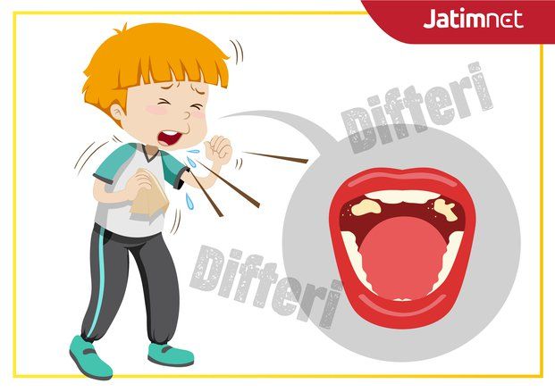 Kota Malang Terpapar Difteri, Dinkes Jatim Gelar Imunisasi November