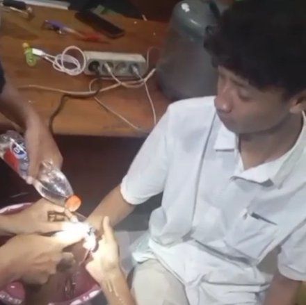 Mainan Borgol Milik Kakak, Tangan Anak di Lamongan Terborgol&nbsp;