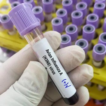 Deteksi Flu Burung dan Pullorum pada Unggas, Lintas Sektor di Jatim Lakukan Pengawasan