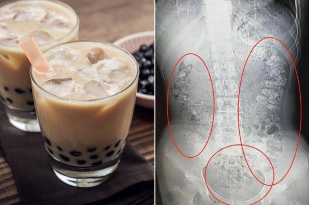 Amankah Teh Mutiara untuk Pencernaan?